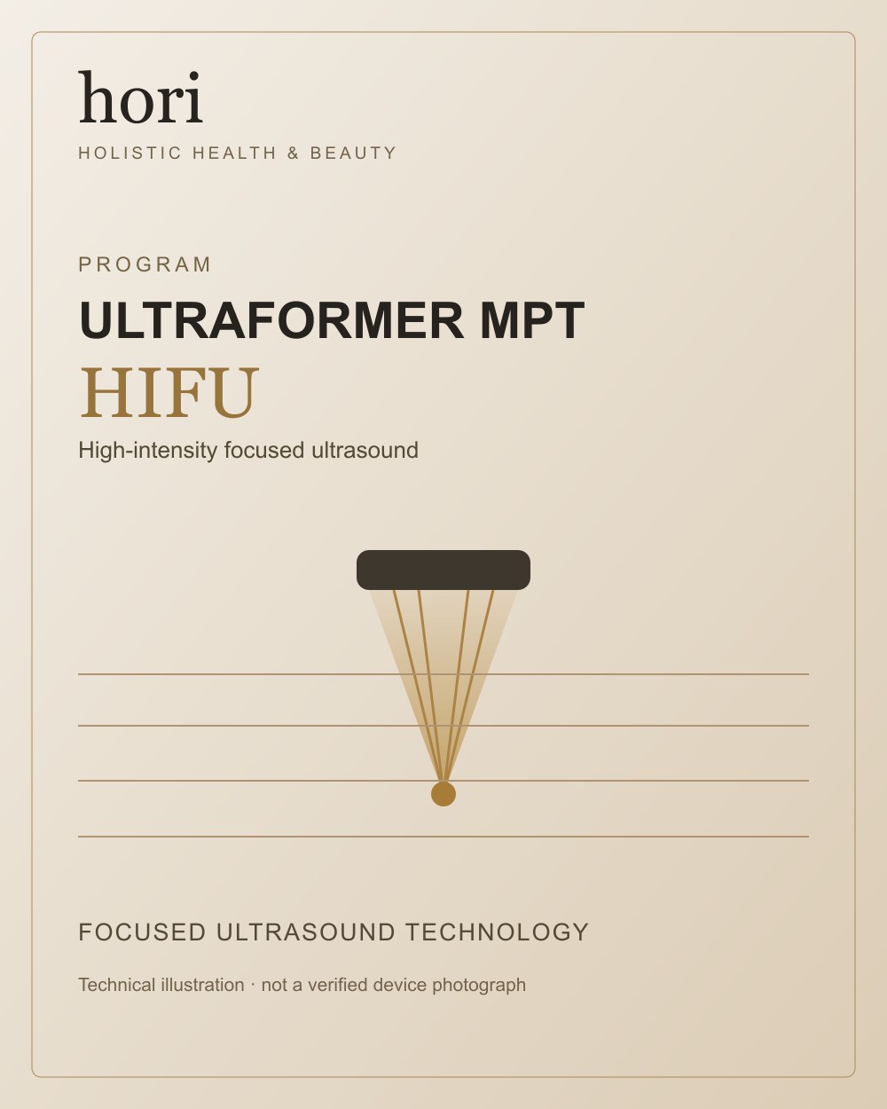 Ultraformer MPT HIFU — technical illustration